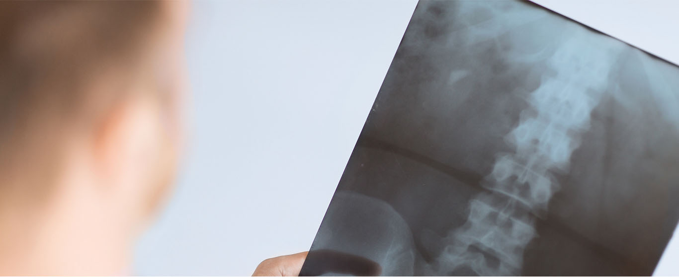 Clinician reviewing a spine X-ray